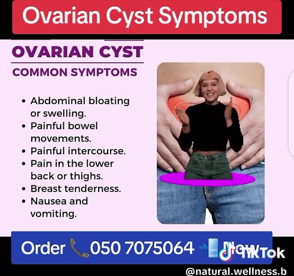 Understanding Fibroids and Ovarian Cysts Symptoms