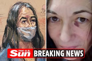 Ghislaine Maxwell seen with black eye in first photo since arrest