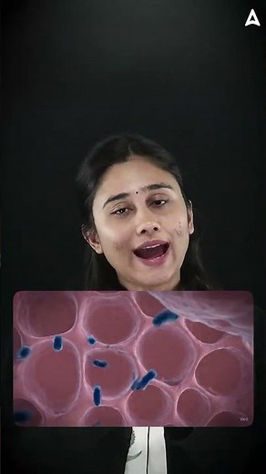 Guess the Disease (Part - 1) | Haemophilus influenzae Disease & Symptoms Explained by Bharti Ma'am!