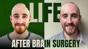 ‘Window to Brain’ ADVANCES Brain-Tumor, Brain Injury Treatment