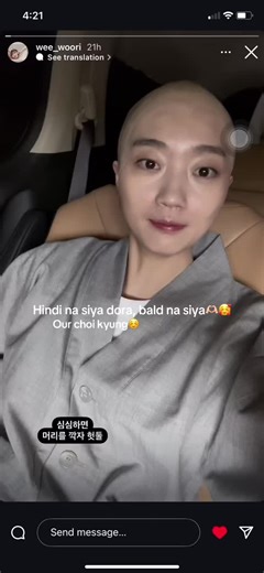 Choi Kyung Joins the Bald Family: New Look Revealed