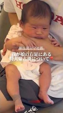 Mongolian spots can appear on the feet?! #Newborn #Baby #MongolianSpots