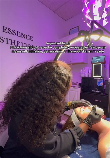 Importancia de las extracciones en el cuidado de la piel