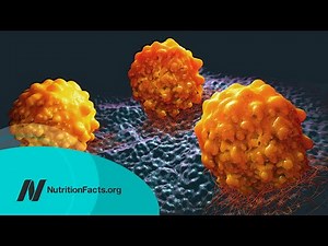 What Causes Cancer to Metastasize?