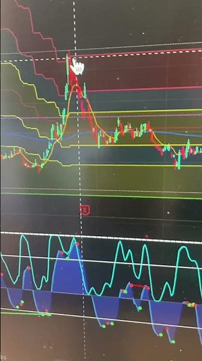 4 Stocks to Watch Right Now!! 🚀 Top Picks for Traders & Investors - August 11, 2025