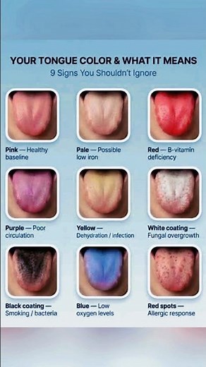 Your Tongue Color & What It Means | Health Warning Signs Explained