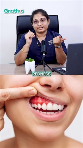 Early Signs of Gum Disease | Bleeding Gums, Bad Breath & Swollen Gums #shorts