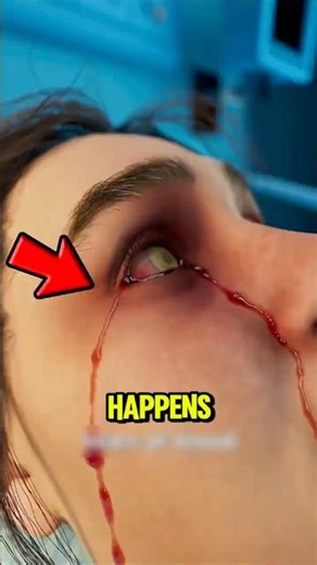 Not Blinking Enough Harms Your Eyes!😱