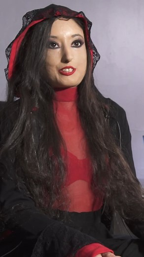 128K views · 2K reactions | My rare condition is making my skin turn into 'stone'... #fbreels #borndifferent #scleroderma #rarecondition #autoimmune #autoimmunedisease | Born Different | Facebook