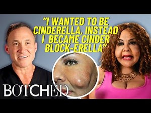 REJECTED by Botched: Rajee’s First Attempt At Removing Cement Filler Injections | Botched | E!