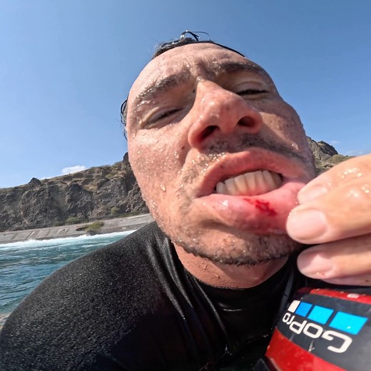 Face plant into the reef in Reunion 🔥 A few shots from the latest collaboration edit with @ziggy_easy #bodyboarding #fblifestyle #bigwaves #slabs #surf #surfing | We Bodyboard