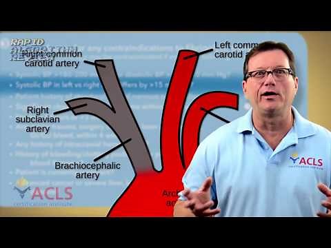 Fibrinolytic Therapy Checklist