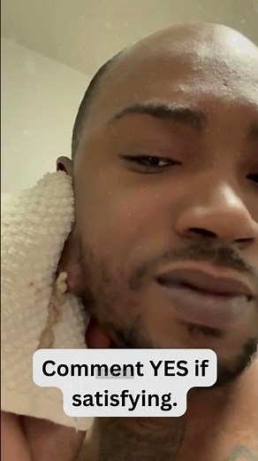 🔥Deep Blackheads, Milia & Whitehead Removal pimple popping New| Big Cystic Acne Extraction#1261 2026