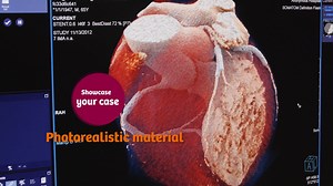 SIEMENS - Syngo.Via Imaging-Software // Produktvideo