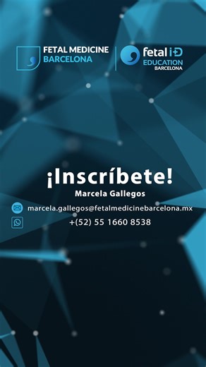 🫀 Compartimos nuestro protocolo de ecocardiografía funcional fetal. ¿Sabías que también tenemos una calculadora de morfometría cardíaca? 👉 https://fetalmedicinebarcelona.org/protocolos/protocolo-ecocardiografia-fetal/ ➡️ El corazón es un órgano clave en el desarrollo del feto, responsable de la perfusión y correcto desarrollo de todos los órganos, de ahí la importancia de realizar un correcto diagnóstico de posibles disfunciones. 📍 Sin embargo, en México, la mortalidad por cardiopatías congén