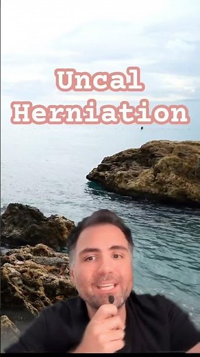 Uncal Herniation: Recognize the Warning Signs and Act Fast! 🧠🚨