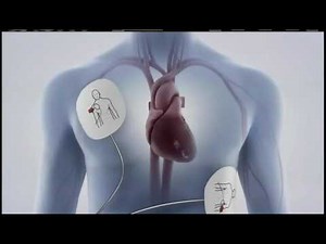Basic Life Support Skills Demonstration