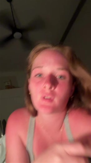 😬😬 #rangalife #australiasummer #burnt #fyp #sunscreen