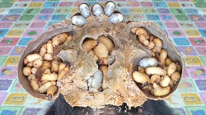 10K views · 88 reactions | Dandruff Removal Satisfying A Lots Giant Worm On Hole Scalp #2050 #ticks #removetick #Dandruff #dandrufftreatment #dandruffremoval | Help remove ticks | Facebook