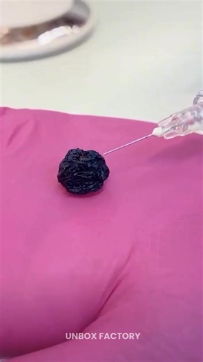 9.7K views · 101 reactions | Next-Gen Cancer Vaccine Machine Offers Safe Tumor Removal #CancerVaccine #MedicalInnovation #TumorTreatment #FutureOfMedicine #CancerCare | Unbox Factory | Facebook