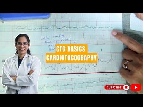CTG (Cardiotocography) Explained | How to Read CTG in Pregnancy & Labour | Dr. Richa