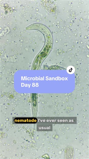 Sandbox Day 88: Use a needle to poke a microbe? 💉 #science #microscope #viral #experimnent