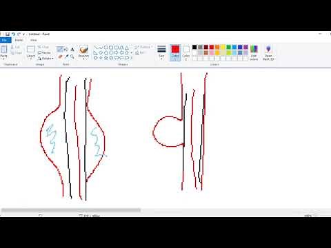 CPT Cardiology Part 2