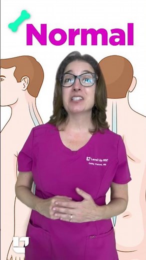 Abnormal Curvatures of the Spine - Musculoskeletal: Medical Surgical SHORT | ‪@LevelUpRN‬