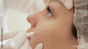 Doctor marks facial zones before injection