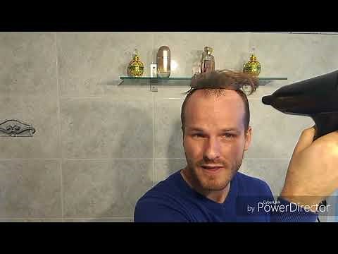 Complément capillaires CCLW: La grosse retouche ligne Frontale *