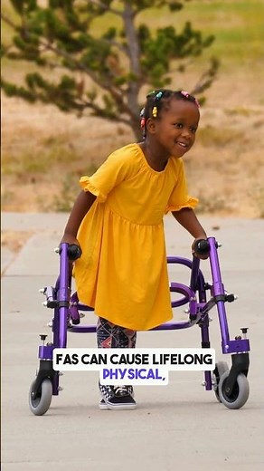 Fetal Alcohol Syndrome