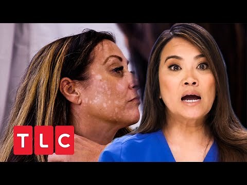 Hässliche weiße Flecken im Gesicht | Dr. Pimple Popper | TLC Deutschland