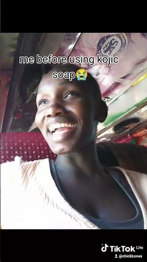 kojie san review before and after use