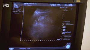 What are the best remedies for a bladder infection?