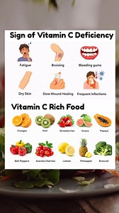 In this Post You will get knowledge about Sign of calcium deficiency with calcium Rich food, sign of vitamin C deficiency with Vitamin C Rich food, and sign of iron deficiency with Iron Rich Food. #calciumdeficiency #IronDeficiency #vitaminc | Coachdebsona