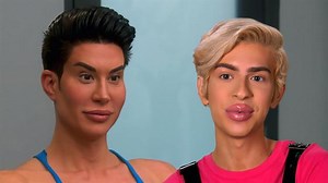 Real Life "Barbie" & "Ken" Fix Botched Surgeries