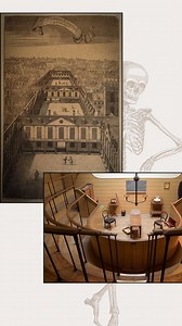 Discover the kinds of operations that once took place inside Europe’s oldest surviving operating theatre. 🏥 Before the arrival of anaesthesia in the late 1840s, surgeons at St Thomas’ Hospital carried out procedures such as amputations, tumour removals, lithotomy for bladder stones, and trephination. Medical students watched these operations from the surrounding benches to learn the techniques that shaped early surgical practice. 🔪 #londonmuseum #londonbridge #medicalstudents #medicalhistory #