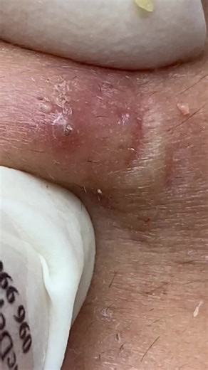 Chăm Sóc Da Mặt Tại Spa Chuyên Nghiệp