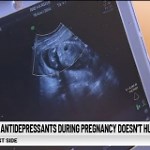 Antidepressant use during pregnancy doesn't harm child development, study says