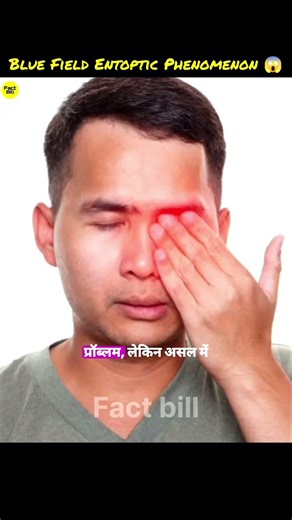 😱 Why do we see transparent dots in sky? 😱 || #shorts #facts #viral