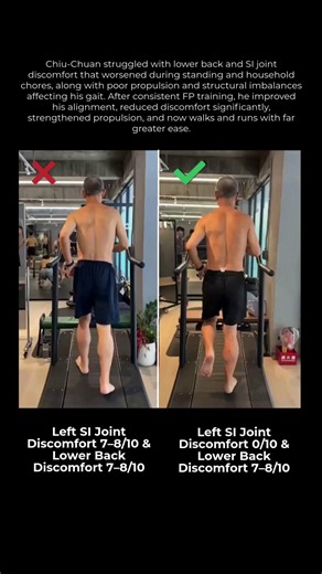 Functional Patterns Evidence Based Practice on Instagram: "Pelvic Compression & Pain to Neutral Alignment, Stability & Light Movement “Chiu-Chuan entered FP training after years of discomfort and unsuccessful physical therapy. With structured FP work, he reduced SI joint discomfort to zero, greatly improved propulsion, and now moves with more elasticity and confidence.” Before FP (Sept 2023, Age 64, 61 kg): ❌ Left SI joint discomfort: 7–8/10 ❌ Lower back discomfort: 7–8/10 ❌ Weak propulsion ❌ Ex