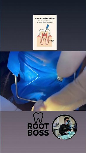 File Impressions in Endodontics