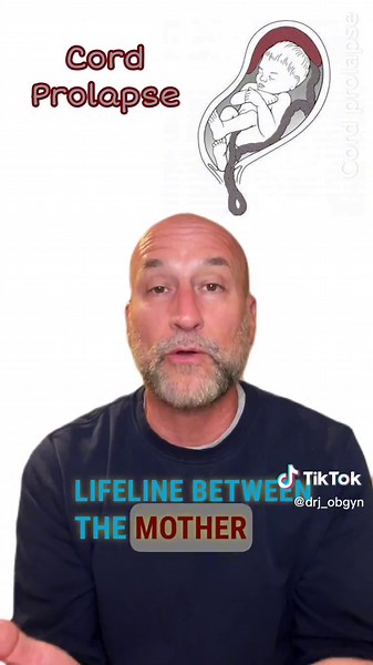 Understanding Cord Prolapse in Pregnancy: Risks, Causes, and Management