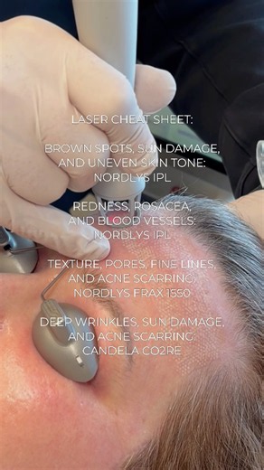 The Best Laser for Sun Damage, Wrinkles, Acne Scars & Redness