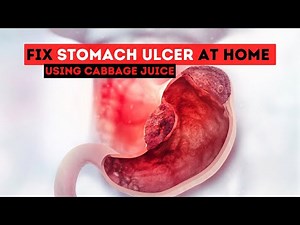 How To Fix Stomach Ulcer at Home Using Cabbage Juice