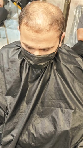 Top Quality Hair Products from Suman Hair Club