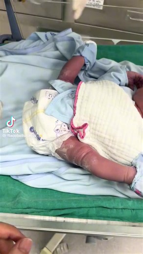 Let him stretch he has been there for a whole 9 months. #newborn #newbornbaby #baby #tik_tok #fyp