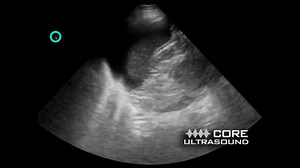 FAST LUQ Positive Narration.mp4