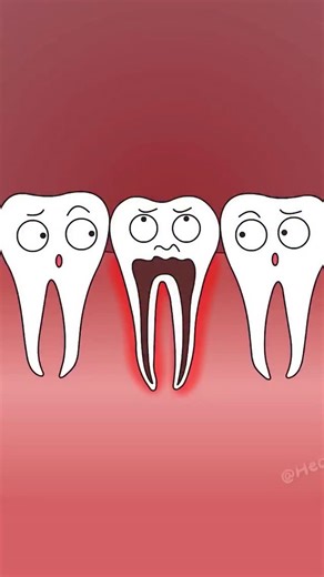 Health | Animation | Body | on Instagram: "Your tooth isn’t dying—it’s being saved 🦷😲 Root canal secrets you should know! Follow @healthmanazer for moree #DentalFacts #ToothCare #OralHealth #HealthTips"