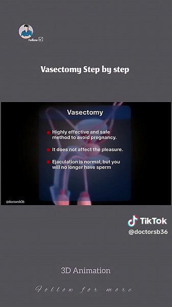 Vasectomy Step by step... . #fyp #foryoupagee #viraltiktokvideo #vasectomy #pregnancy #capCut #1millionaudition #fyppp #foryouofficial @Dr muskan @Dr Sadia 🥼
